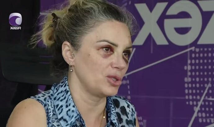  Bakıda mağazada döyülən qadın danışdı - Video  
