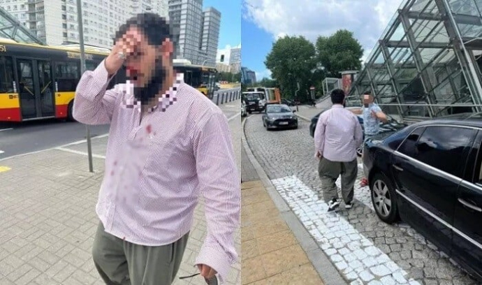  Polşada azərbaycanlı taksi sürücüsünü döyənə cinayət işi açıldı  